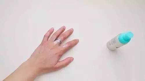 戒指和手鐲取不下來