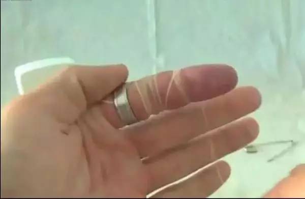 戒指和手鐲取不下來
